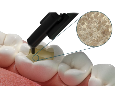 Фибрафил Дентин  20 унидоз х 0,25 г (Fibrafill Dentin)