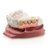 Гингифаст эластик (Gingifast Elastic)